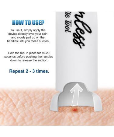 Portable Bug Bite Itch Relief Suction Tool - Small Size Poison Remover for Instant Insect Bite Relief | Pack of 10 - Buy Online on SooperMarket.com