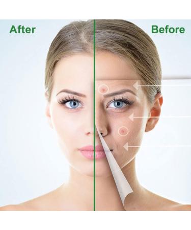 Acne Healing Patch Acne Absorbing Cover Invisible Skin Acne Treatment Stickers for Facial 24Patches acne treatment - Buy Online on SooperMarket.com