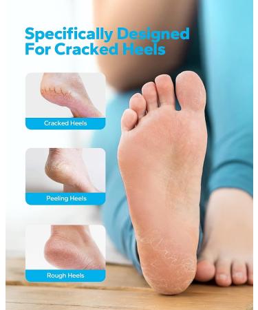 MoistMate Heel Socks for Dry Cracked Feet - Foot Care Repair and Moisturizing - Aloe Spa Socks for Men and Women (Grey, 2 Pairs) - Buy Online on SooperMarket.com