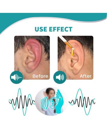Non-Pungent Tinnitus Ear Drops - Lightweight Functional Relief Oil with Herbs - Style A Color 10ML - Buy Online on SooperMarket.com