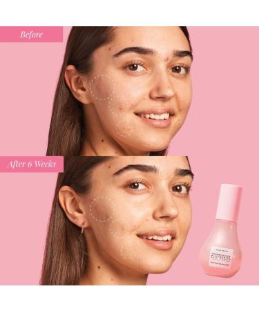 Watermelon Glow Niacinamide Dew Drops Mini - Brightening Serum 15ml - Buy Online on SooperMarket.com