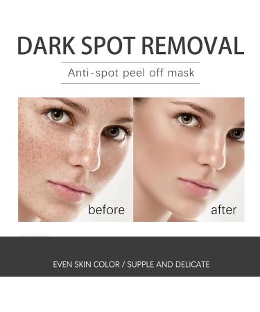 Dark Spot Remover for Face Hyaluronic Acid Dark Spot Correcting Serum Anti Aging Face Serum for Women Nicotinamide Dark Spot Correcting Glow Serum Anti Spot Face Serum and Oil Skin Moisturizer-30ml - Buy Online on SooperMarket.com