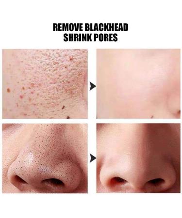 30pcs Exfoliating Silkworm Balls for Blackhead Removal Silks with Deep Cleansing and Skin Care - Buy Online on SooperMarket.com
