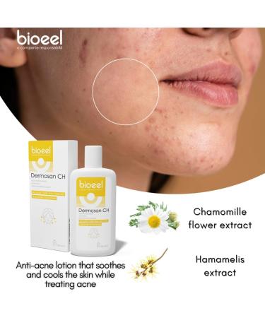 Dermosan CH Anti-Acne Lotion - Chamomile & Hamamelis Natural Clear Skin Formula - Reduce Sebum Acne and Pimple 120ML - Buy Online on SooperMarket.com