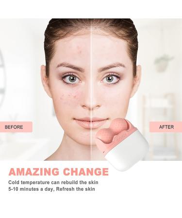 Ice Roller for Face and Eyes - Facial Skin Care Tool with 2-in-1 Roller and Carry Case - Reduce Puffiness, Relieve Migraine Pain - Women's Gift (Pink) - Buy Online on SooperMarket.com