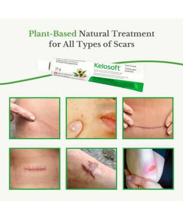 Kelosoft - Natural Scar Removal Cream Keloid Scar Removal Gel Plant Based Herbal Scar Cream Helps Reduce Visibility of Scars - 25g - Buy Online on SooperMarket.com