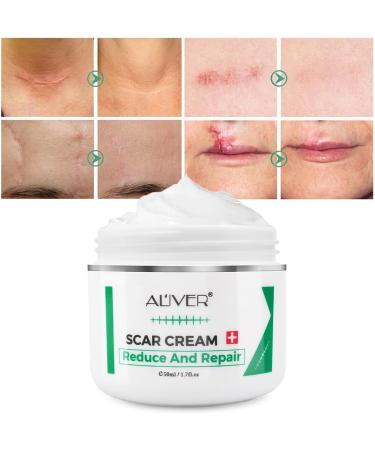 Scar Repair Cream | Acne Scar Removal & Pigmentation Corrector | Stretch Mark Remover | Skin Whitening | Scar Care - Buy Online on SooperMarket.com