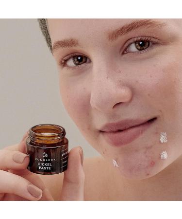 JUNGL CK Pimple Paste - Creamy Anti-Acne Treatment for Blemishes | Soothing & Anti-Inflammatory Formula for Clear Skin - Buy Online on SooperMarket.com