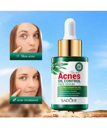 Tea Tree Oil for Face - Acne Serum & Blemish Spot Treatment - Unclogs Pores Soothes Breakouts - 1 fl oz for Smooth Glowing Skin - Buy Online on SooperMarket.com