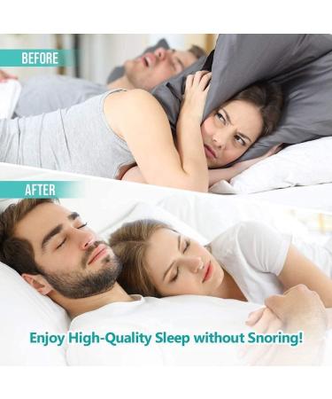 Silicone Magnetic Anti Snoring Clips - Set of 4 | Snore Stopper Nasal Dilator for Men and Women - White - Buy Online on SooperMarket.com