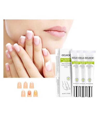 Yueci Hand and Foot Care Cream | Heal Damaged Nails & Cracked Skin | Nail Repair Treatment for Renewed Beauty - Buy Online on SooperMarket.com