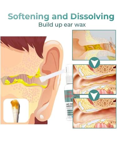 Anti Tinnitus Earwax Removal Spray - 3PC Set for Ear Wax Softening & Cochlear Blockage Relief - Buy Online on SooperMarket.com