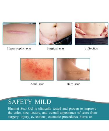 Silicone Scar Tape 4cm x 1.5m - Self Adhesive & Non-irritating - C Section & Burn Scar Removal - Meat Color - Buy Online on SooperMarket.com