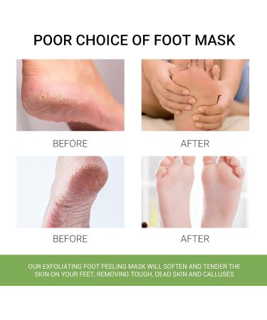 3 Pairs Foot Peel Mask Socks - Hydrating Foot Spa Treatment for Dry & Cracked Feet - Cornea Removal & Moisturizing Effects for Men & Women - Buy Online on SooperMarket.com