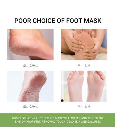 4 Pair Foot Mask Peeling Socks - Baby Smooth Feet Corny Skin Remover Rough Heel Repair - Unisex Mixed Pack - Buy Online on SooperMarket.com