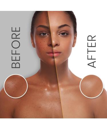 Makari Classic Body Beautifying Whitening Milk 4.75 fl.oz Lightening & Moisturizing Body Lotion with Vegeclairine Whitening Treatment for Dark Spots Acne Scars & Stretch Marks - Buy Online on SooperMarket.com