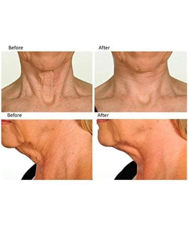 Neck Rescue Instant Correcting Strips - Improve & Tighten Neckline - 30 Count - Buy Online on SooperMarket.com