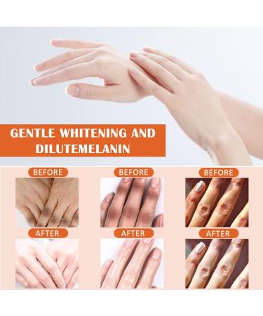 Fengyang Skin Whitening Serum Dark Knuckle Whitening Cream Dark Knuckle Whitening Serum Dark Knuckle Whitening Lotion Removing Dark Ankle Fingers - Buy Online on SooperMarket.com