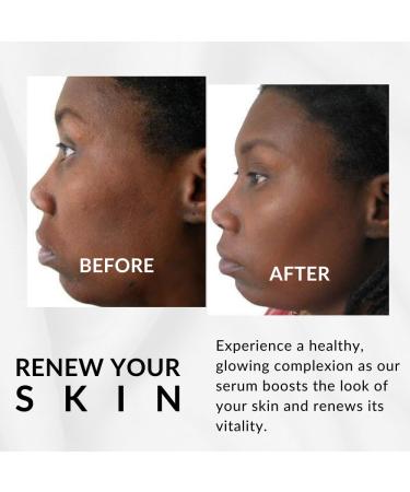 Perfect Tone Moisture Serum by Flori Roberts | Reduce Dark Spots & Hyperpigmentation | Boost Radiance & Smooth Wrinkles - Buy Online on SooperMarket.com