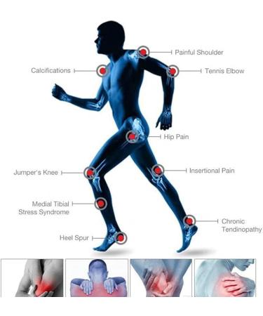 Buy Auto Parts Shock Wave Therapy Device - Deep Muscle Massager & ED Extracorporal Physiotherapy Instrument - Buy Online on SooperMarket.com
