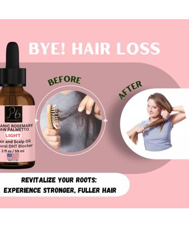 Organic Rosemary & Saw Palmetto Hair Growth Blend | Nourishing Formula for Hair Loss Regrowth & Strength - 2 fl oz - Buy Online on SooperMarket.com