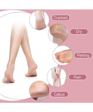 Sibba 4 Pairs Moisturizing Gel Heel Socks Cracked Heel Gel Lined Infused Toeless Spa Socks for Women Soft Cotton Silicone Ventilate Heel Sleeves Open Toe Foot Care Treatment Overnight (Multicolor) 4 Pairs Black+Pink+Gray+Green 4.0 - Buy Online on SooperMarket.com