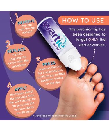 Wartie Advanced Extra Strength Gel 50ml - Fast Wart & Verruca Remover - Buy Online on SooperMarket.com
