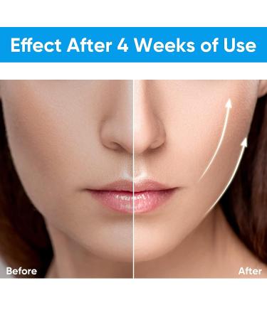Electric Double Chin Reducer with Blue Red Light for Skin Lifting & Shaping - Buy Online on SooperMarket.com