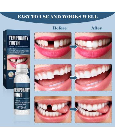 Temporary Tooth Set Tooth Repair Kit Temporary Teeth Replacement Kit for Chipped Teeth Moldable False Teeth Temporary Filling for Tooth - Buy Online on SooperMarket.com