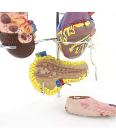 Model Model of Diabetes Complications Heart Pancreas Brain Neuron Model Foot Medical Communication Aids for The Diabetes Demonstration - Buy Online on SooperMarket.com