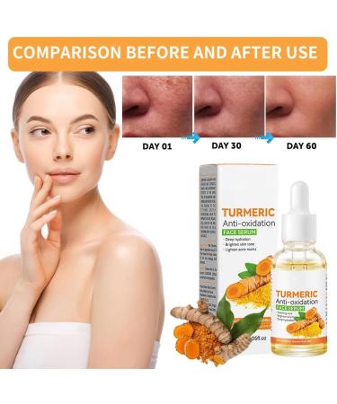 Turmeric Serum Dark Spot Corrector Serum Turmeric Face Serum Skin Corrector Serum Deep hydration Brighten Skin Tone dark spot remover glowing and blemish free skin facial serum for women/Men 30ML - Buy Online on SooperMarket.com