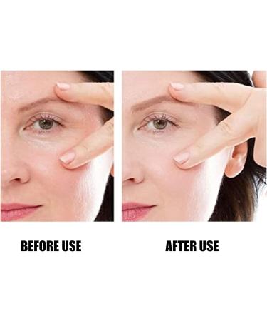 Wrinkle Patch Eliminate Wrinkles Patch Light in Weight Designed To Remove Wrinkles Around the Eyes for Home Use - Buy Online on SooperMarket.com