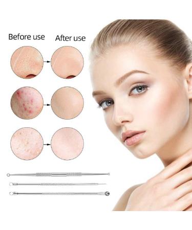 9PCS Blackhead Remover Comedone Extractor Kit with Tweezers and Free Eyebrow Brush - Buy Online on SooperMarket.com
