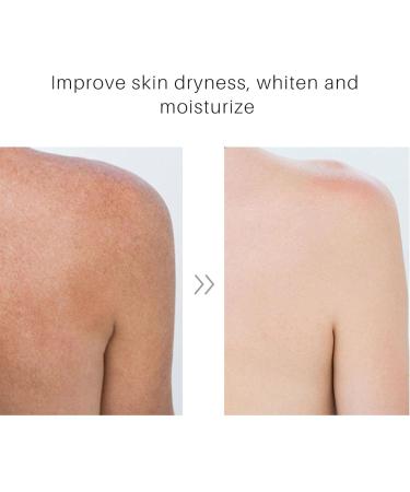 FAYNDE Turricum Body Cream 100ml - Nourishing Daily Skin Care with Ginger Extract for Women & Teens | Ideal for Back Neck Shoulders Arms & Legs - Buy Online on SooperMarket.com