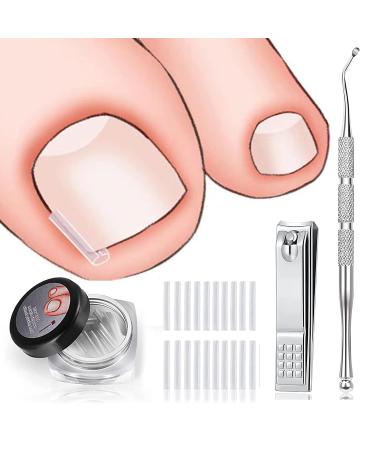 (60+2) Pack Ingrown Toenail Treatment, Include 60 PCS Ingrown Toenail Corrector Strips, Ingrown Toenail Lifter And Nail Clipper, Professional Ingrown Toenail Correction Tool
