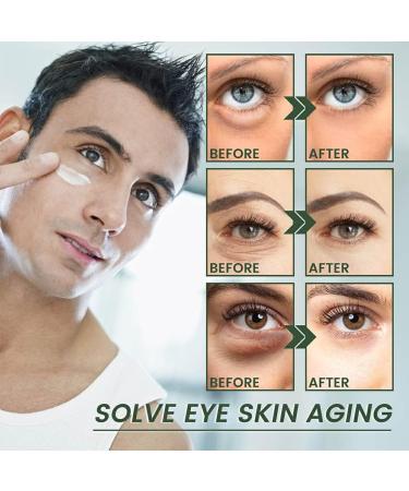FIOERDTUIE Adults Eye Tightening Cream Nourishing Anti-wrinkle Dark Circle Creams Wrinkle Remover Skin Care Beauty Supplies - Buy Online on SooperMarket.com