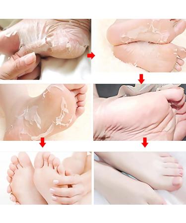 Bexdug Foot Peeling Mask - Exfoliating Peeling Socks for Soft Smooth Feet | Moisturizing Treatment & Dead Skin Remover | Heel Repair | 1 Piece - Buy Online on SooperMarket.com