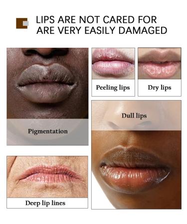 H.D.S.N. Lip Scrub 20g - Natural Exfoliator for Dry & Dark Lips - Moisturizing Balm for Smokers - 0.7 Fl Oz (Pack of 1) - Buy Online on SooperMarket.com