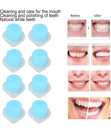 20PCs Professional Dental Polishing Cream - Safe & Effective Tooth Protection | Super White Oral Care (Blue) - Buy Online on SooperMarket.com