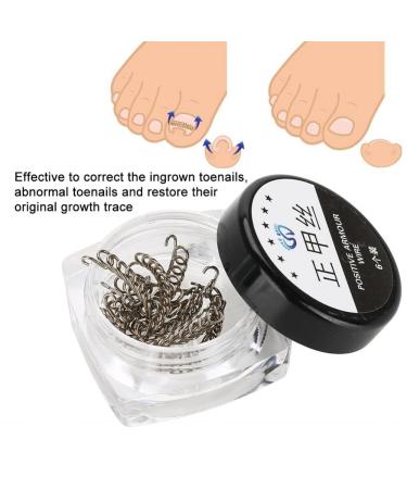 Nail Corrector Pedicure Tool - 12Pcs/Box Toenail Correction Kit for Ingrown Nails - Foot Care Fixer in 6 Sizes - Buy Online on SooperMarket.com