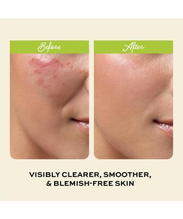 Clarifying Toner for Face - Salicylic Acid Toner - Spot and Oil Control Cruelty-Free Skincare by The Natural and Organic Family - 7.04 oz Apple - Buy Online on SooperMarket.com