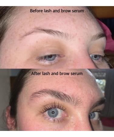 Lash Therapy Australia Eyebrow Growth Serum - Promotes Fuller and Thicker Brows - Buy Online on SooperMarket.com