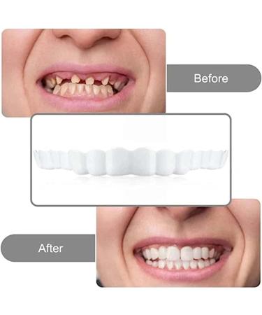 LAMILL DIY Dentures Teeth Veneers for Men and Women - Elastic Tooth Cover - Perfect Smile Solution (2 PCS) - Buy Online on SooperMarket.com