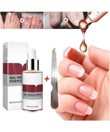 1PC Nail Treatment Nail Renewal Solution Toenails & Fingernails Nail Repairs Essential Oil Protects Toenail Fungus Treatment From Discoloration Brittle And Cracked Nail(12ML) - Buy Online on SooperMarket.com