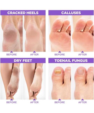 Lavender Oil Foot Soak with Epsom Salt for Dry Cracked Feet - Made in USA - 1 LB Lavender - Softens Calluses, Soothes Sore Feet & Removes Odor - Athlete's Foot Relief - Buy Online on SooperMarket.com