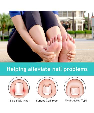 Ingrown Toenails Set Toenail Correction Toenail Toenail Patch Ingrown Toenails Tool Set Toenail Corrector Pedicure Tools Correction Sticker Toe Nails 21 Pieces - Buy Online on SooperMarket.com
