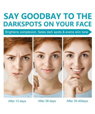 Fast-Acting Dark Spot Remover for Face & Body | Hyperpigmentation & Melasma Corrector | Even Skin Tone | Age Spot Treatment for Men & Women - Buy Online on SooperMarket.com