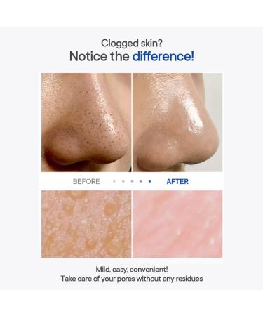 P.Z. Ssoc Ssoc No More Blackhead 3.4 fl oz - Korean Skin Care for Pore Clearing and Sebum Control - Buy Online on SooperMarket.com