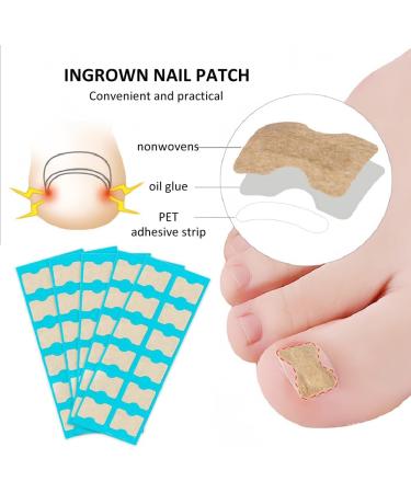 Toenail Patch Ingrown Toenail Toenail Correction Toenail Correction Patch Toenail Correction Patch Ingrown Toenail Nail Care 50 Pieces - Buy Online on SooperMarket.com