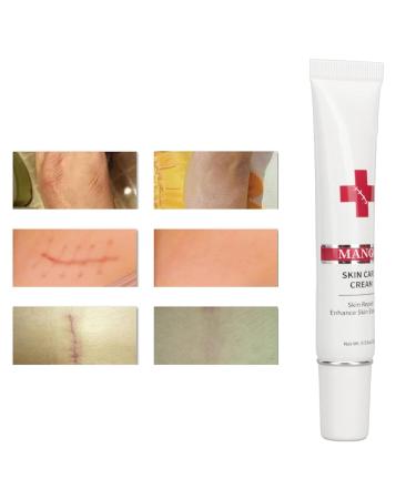 Nourishing Plant Based Scar Cream for Safe & Gentle Scar Repair - Buy Online on SooperMarket.com